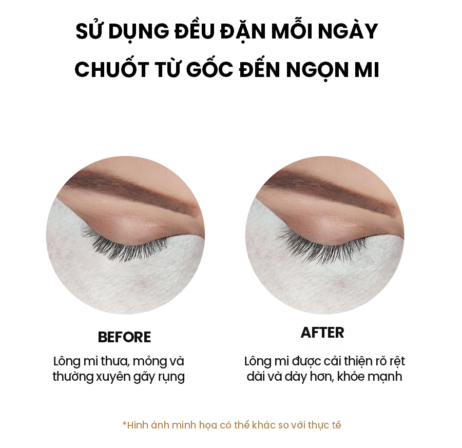 Tinh Chất Dưỡng Dài Mi WHISIS Collagen V-B7 Eyelash Volume Ampoule